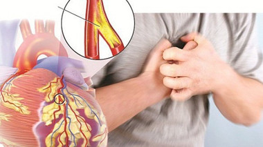 Nhận biết và phòng ngừa bệnh mạch vành
