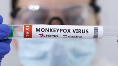 Có cần thiết tiêm vắc-xin phòng bệnh đậu mùa khỉ hay không?